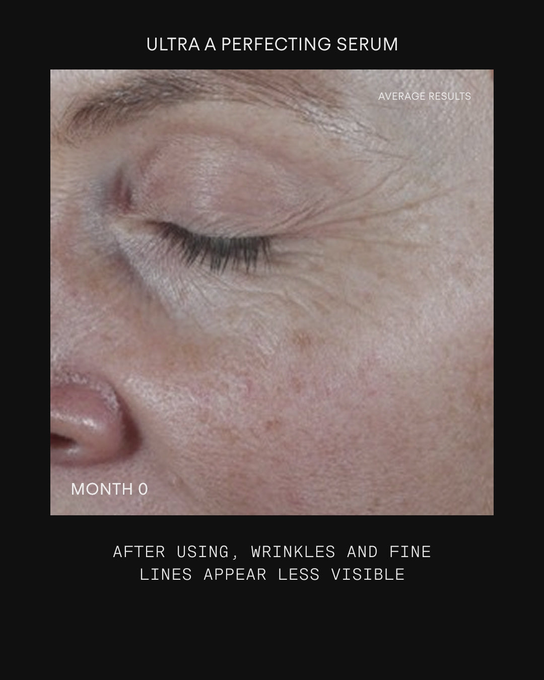 Ultraceuticals Retinome Facial Serum Mild results for visibly smoother skin, softened fine lines and improved texture.
