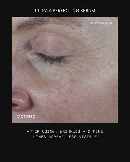 Ultraceuticals Retinome Facial Serum Mild results for visibly smoother skin, softened fine lines and improved texture.