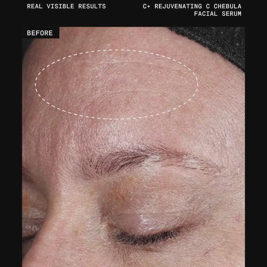 Ultraceuticals C+ Rejuvenating C Chebula Facial Serum before and after results for improved firmness and complexion radiance.