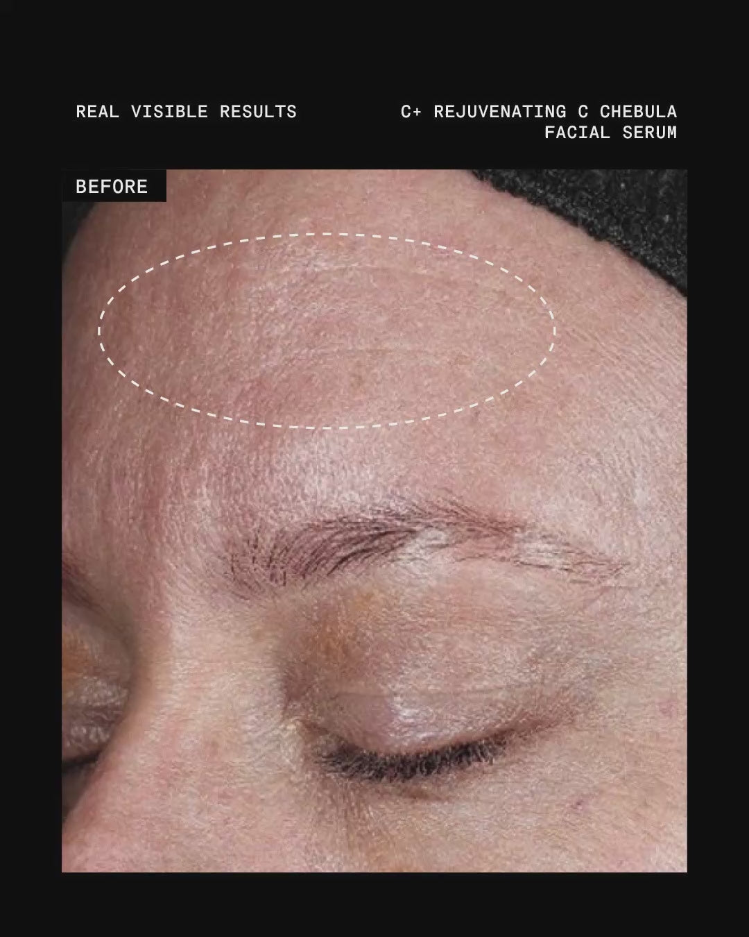 Ultraceuticals C+ Rejuvenating C Chebula Facial Serum before and after results for improved firmness and complexion radiance.
