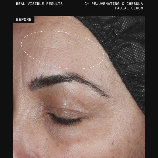 Ultraceuticals C+ Rejuvenating C Chebula Facial Serum before and after results for smoother, more youthful-looking skin.