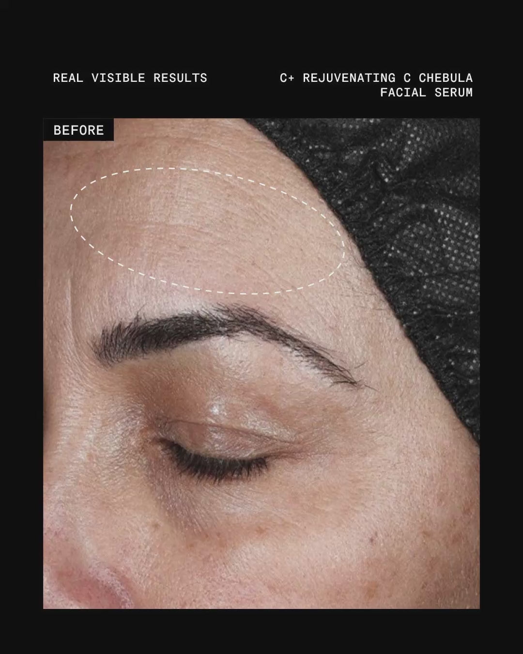 Ultraceuticals C+ Rejuvenating C Chebula Facial Serum before and after results for smoother, more youthful-looking skin.